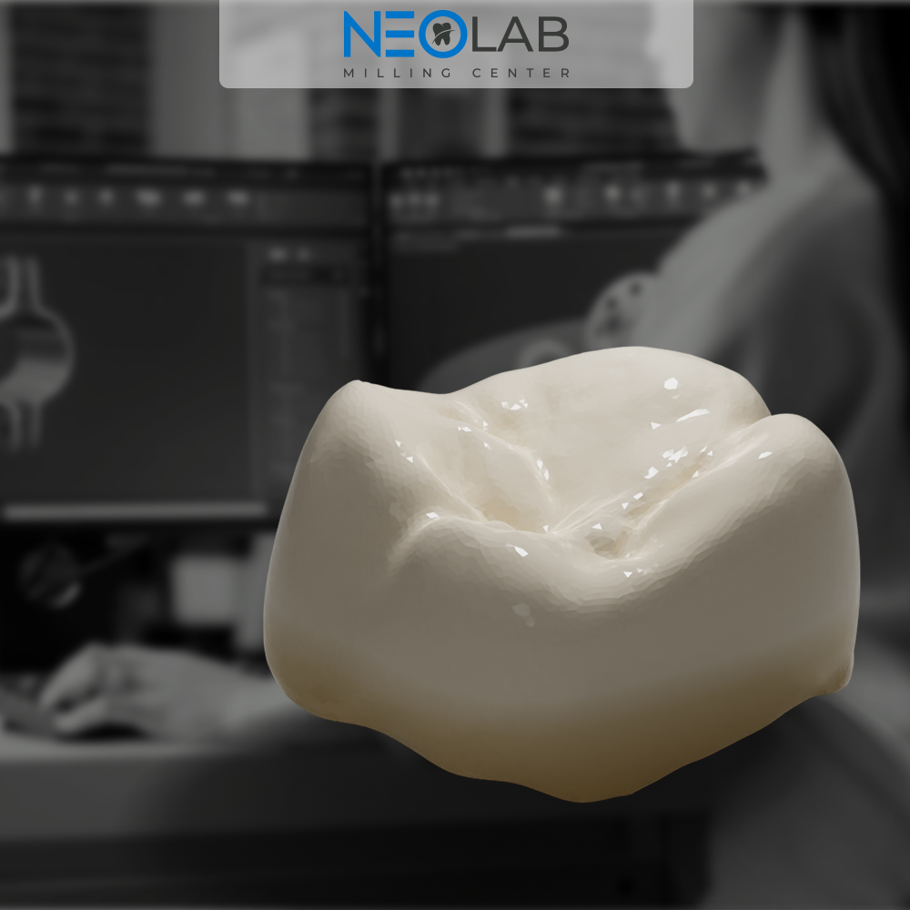 Design Service Crown – Neo Lab Milling Center