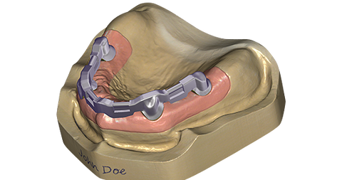 CAD Design Software exocad Bar