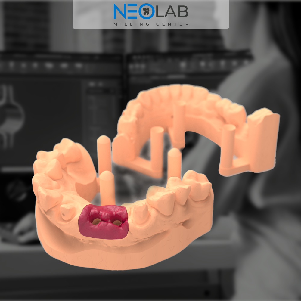 Design Service Dental Model – Neo Lab Milling Center