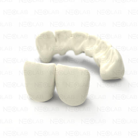 Crown Temporary mSLA 3D Print