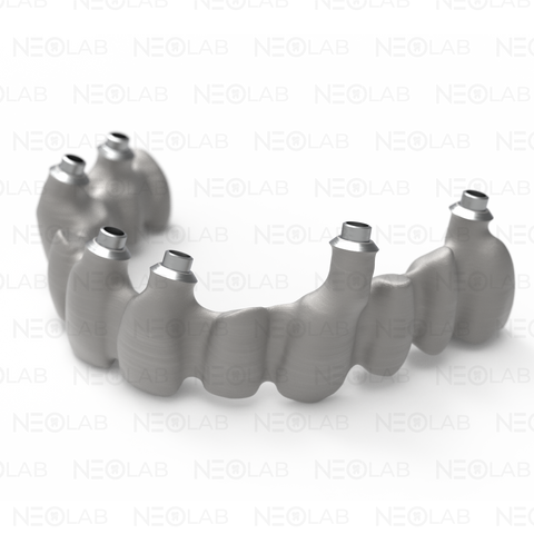 Implant Bridge/Bar (per Implant) CoCr SLM 3D Print + Mill Finish